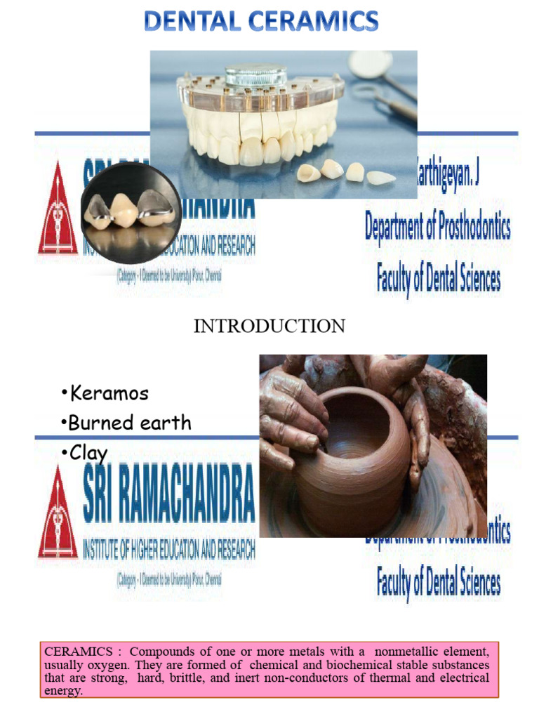 Overview of Dental Ceramics | PDF | Glasses | Ceramics