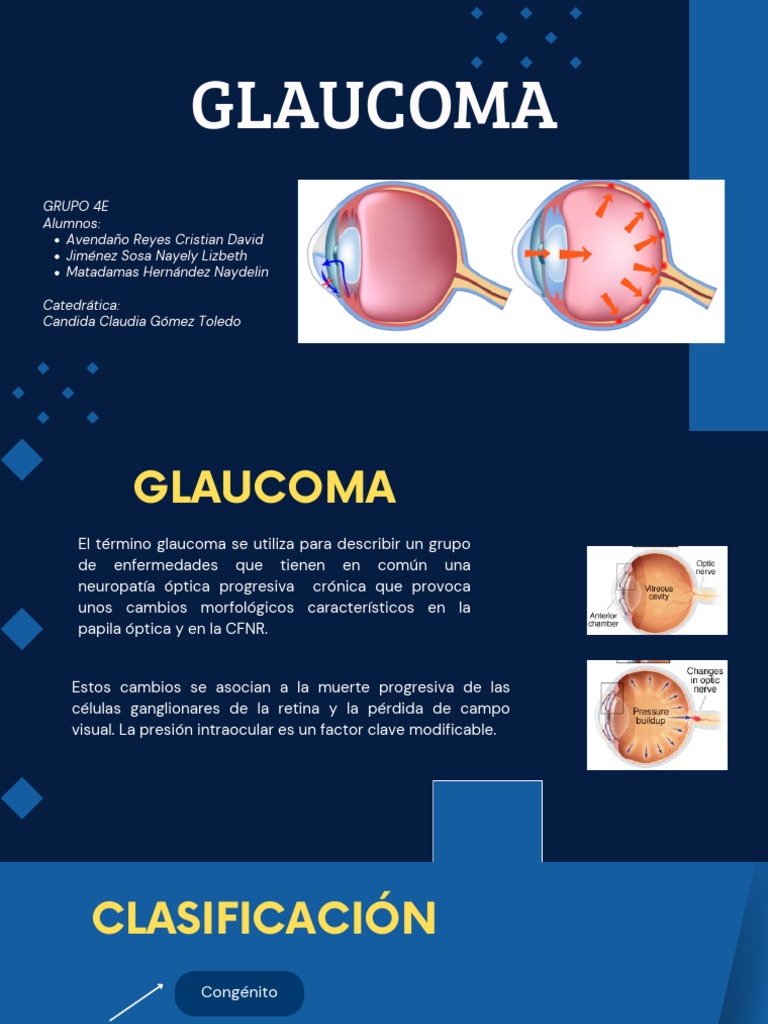 Glaucoma: Diagnóstico y Tratamiento | PDF | Glaucoma | Percepción visual