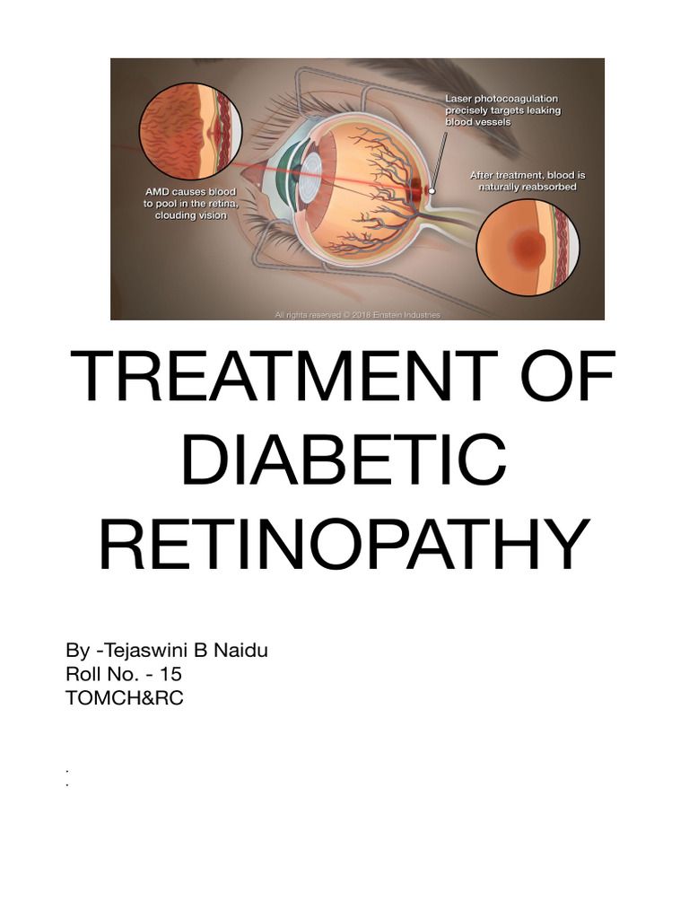 Treatment of Diabetic Retinopathy | PDF