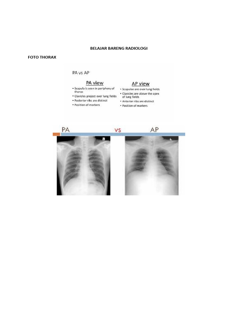 Sinus Phrenicocostalis pada Foto Thorax | PDF | Kajian Bahasa Asing