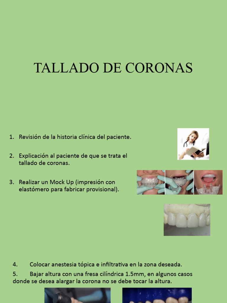 4. Tallado de coronas | PDF