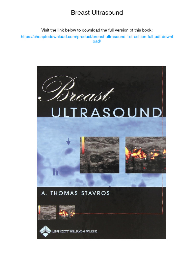 健康・医学 Breast Ultrasound A. Thomas Stavros Breast Ultrasound: 9780397516247: Medicine & Health Science