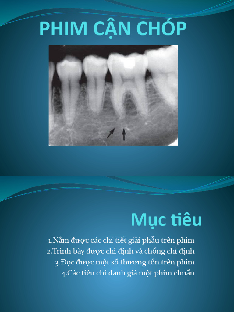 PHIM CẬN CHÓP | PDF