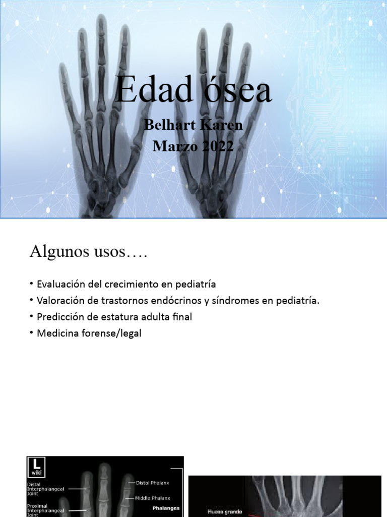 Edad Osea | PDF | Sistema musculoesquelético | Sistema esquelético
