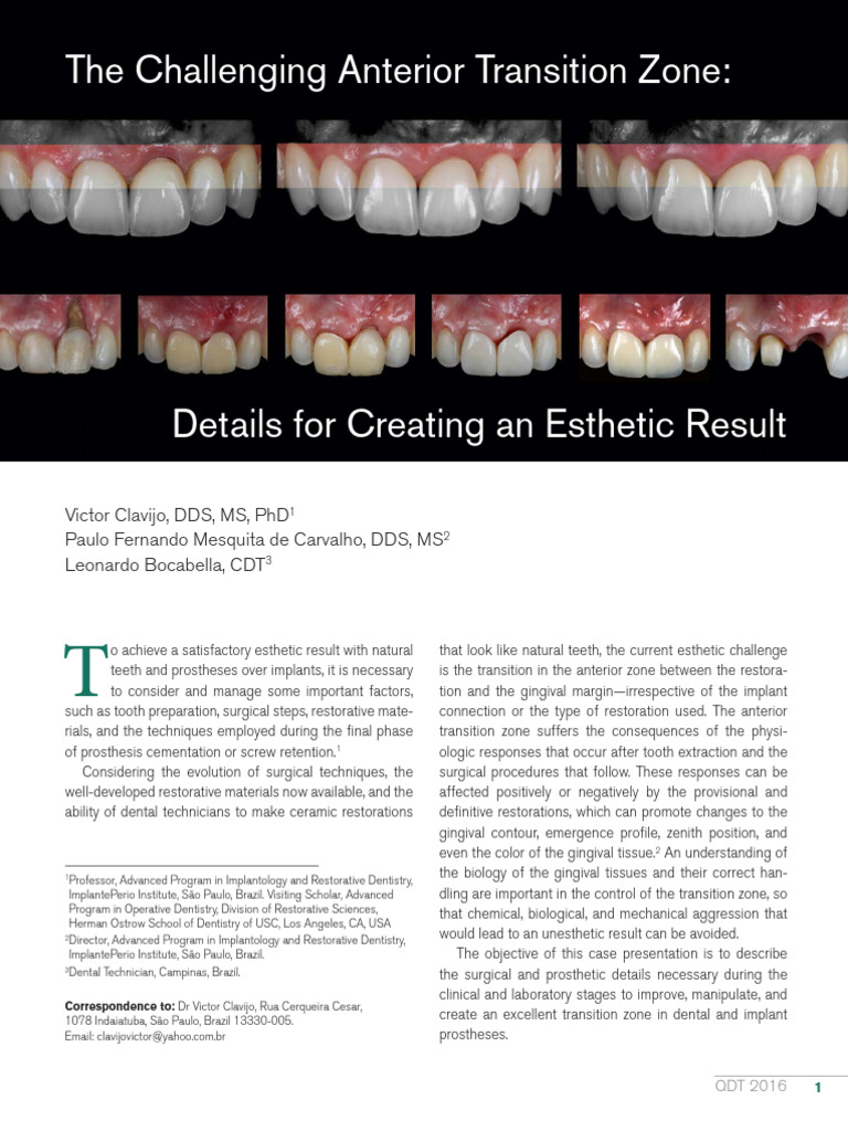 Anterior Transition Zone in Dentistry | PDF | Dental Implant | Mouth