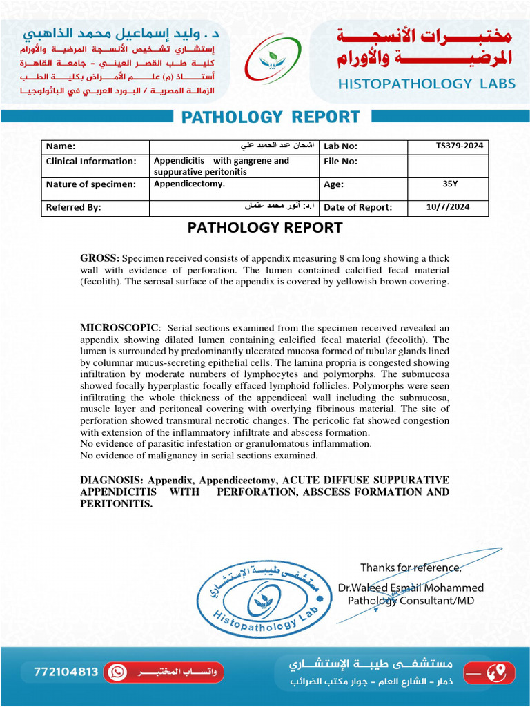 Acute Suppurative Appendicitis Report | PDF