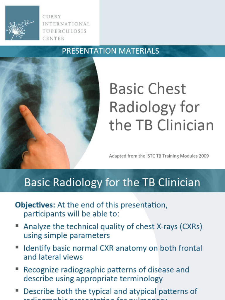 Chest Radiology Basics for TB Clinicians | PDF | Lung | Aorta
