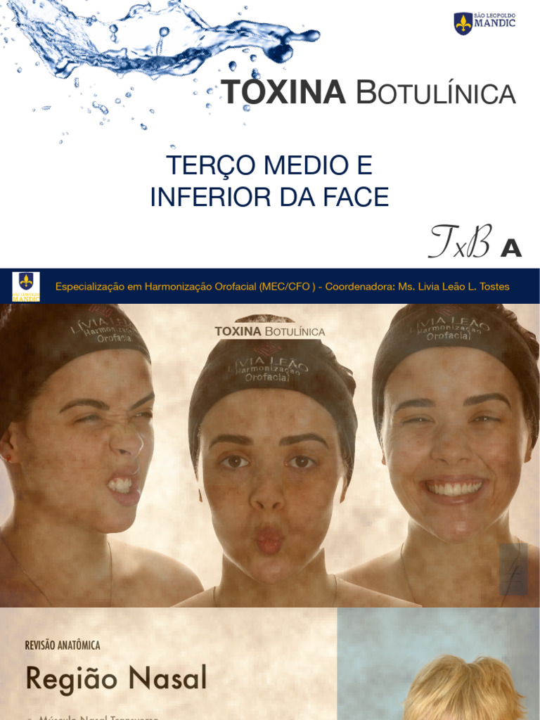 Aplicações de Toxina Botulínica na Face | PDF | Toxina botulínica ...