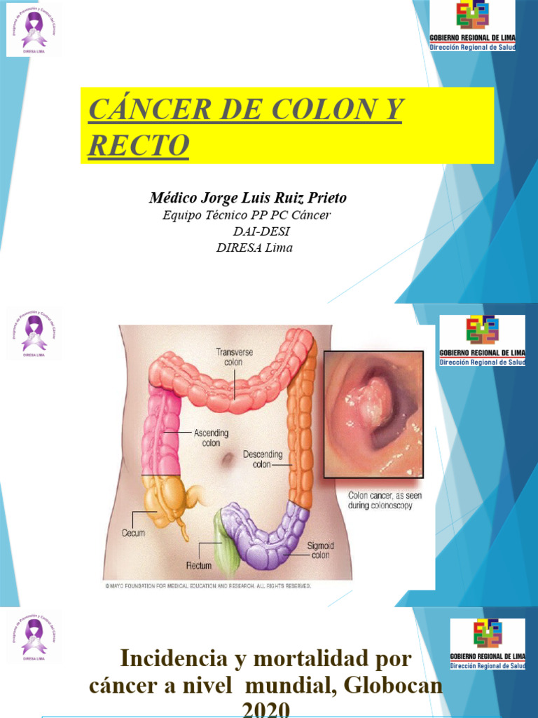 Cáncer de Colon y Recto: Prevención y Datos | PDF | Obesidad | Cáncer
