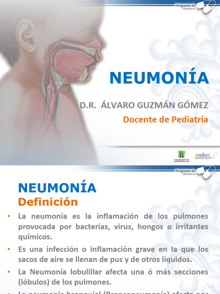 Neumonia Clase Magistral U De Manizales Pediatria Pdf Neumonía