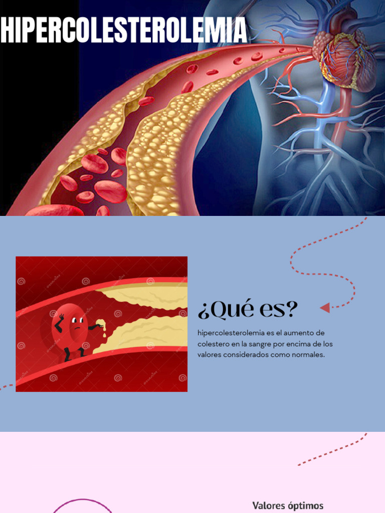 Hipercolesterolemia 20240802 191800 0000 | PDF | Hipercolesterolemia ...