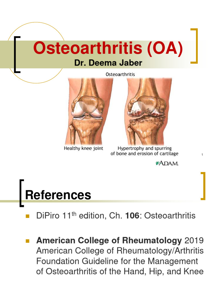 Osteoarthritis New Pdf Osteoarthritis Arthritis
