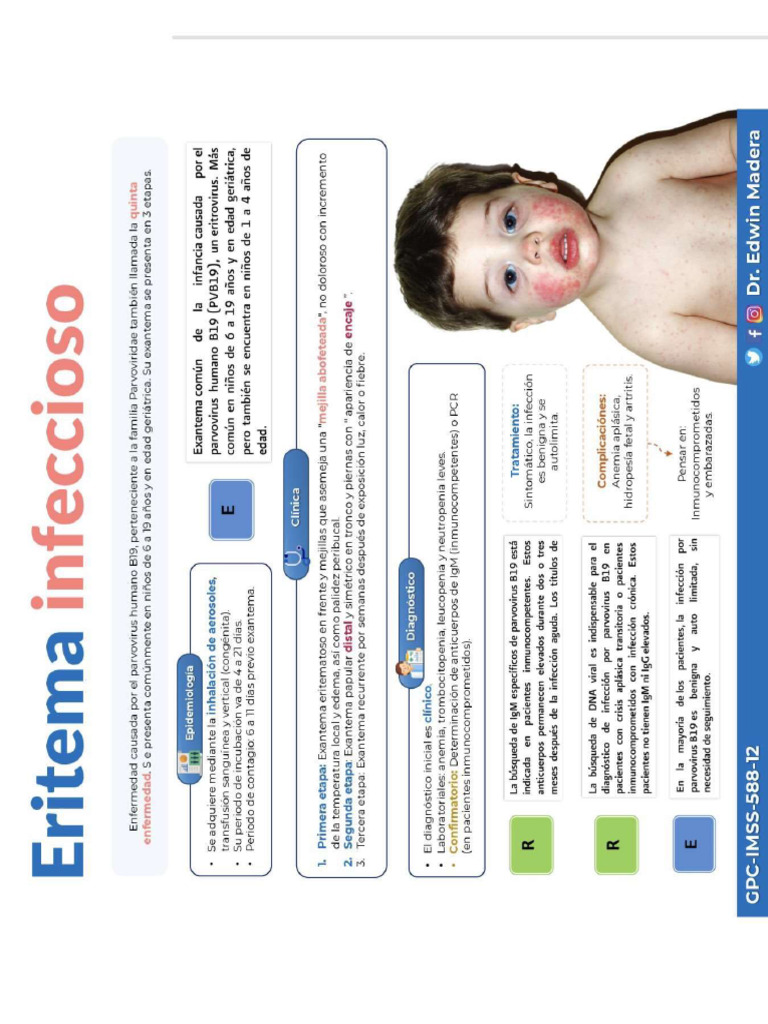 Eritema Infeccioso | PDF