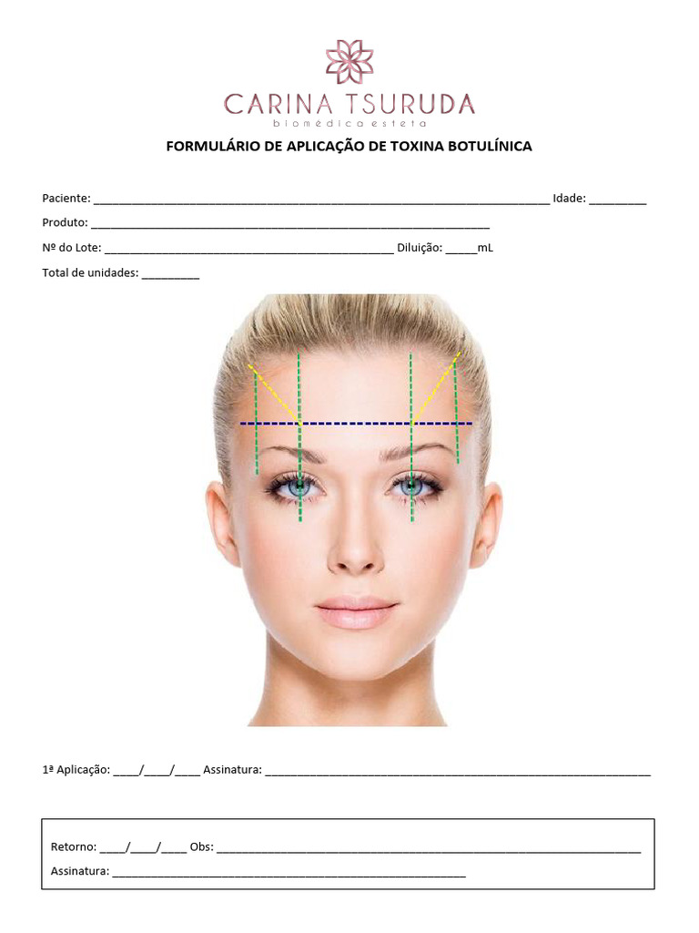 Formul rio de aplica o de toxina botul nica pdf