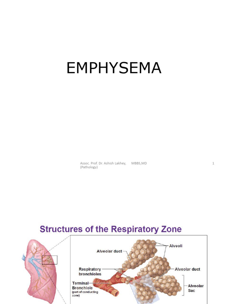 Emphysema 2024 | PDF | Lung | Chronic Obstructive Pulmonary Disease