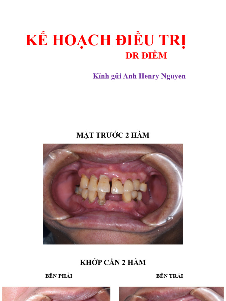 Khﾄ慎 Henry Nguyen Pdf