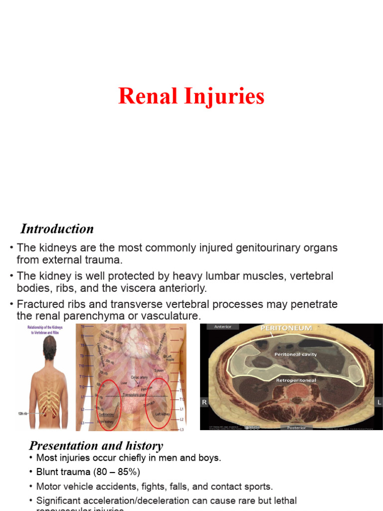 Renal Injuries Presentation Pdf Kidney Ct Scan