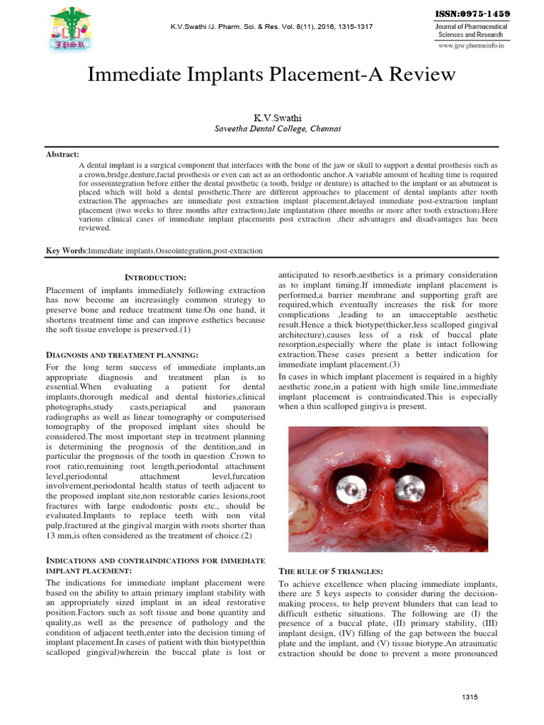 Immediate Implants Placement | PDF | Dental Implant | Periodontology