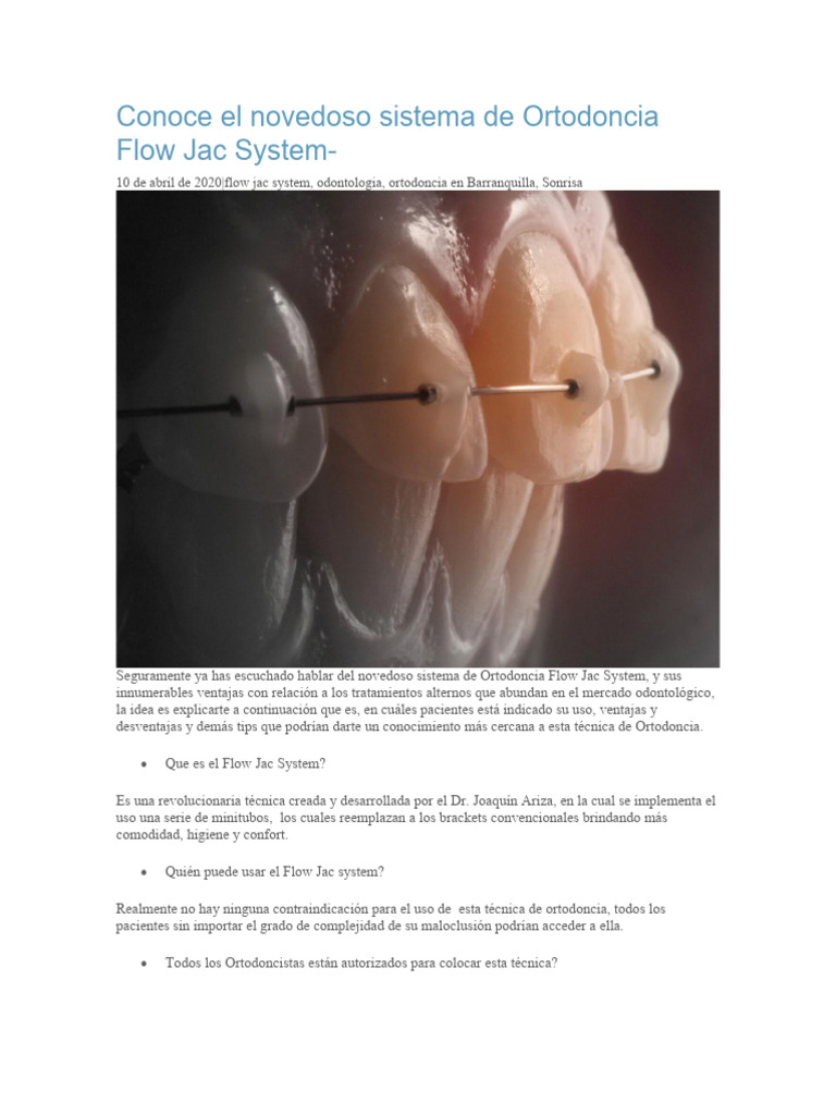 Ventajas del Flow Jac System en Ortodoncia | PDF | Ortodoncia | Odontología