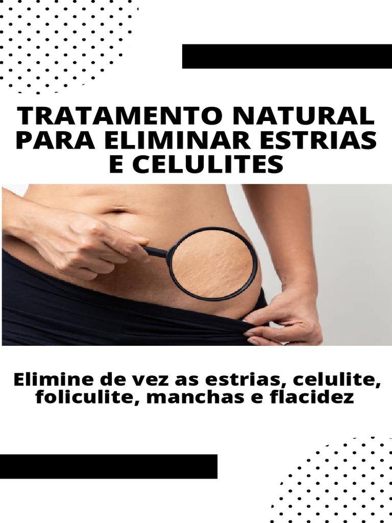 Cremes Caseiros para Eliminar Estrias | PDF | Vitamina | Batata