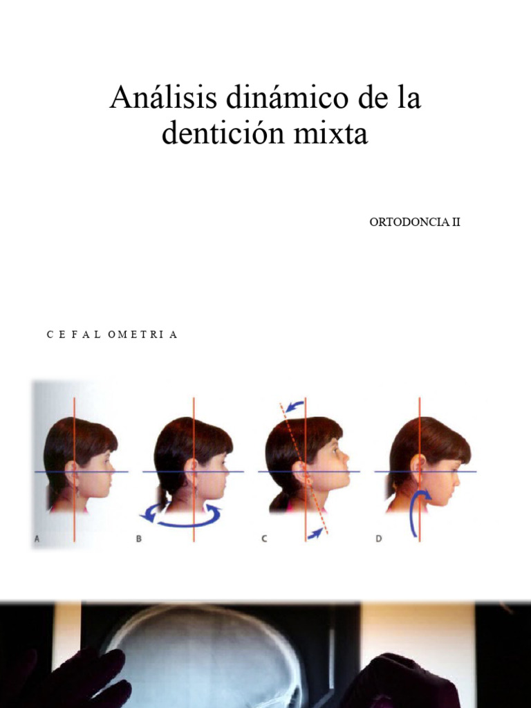 Clase 4 Análisis Dinámico de La Dentición Mixta | PDF | Cráneo ...