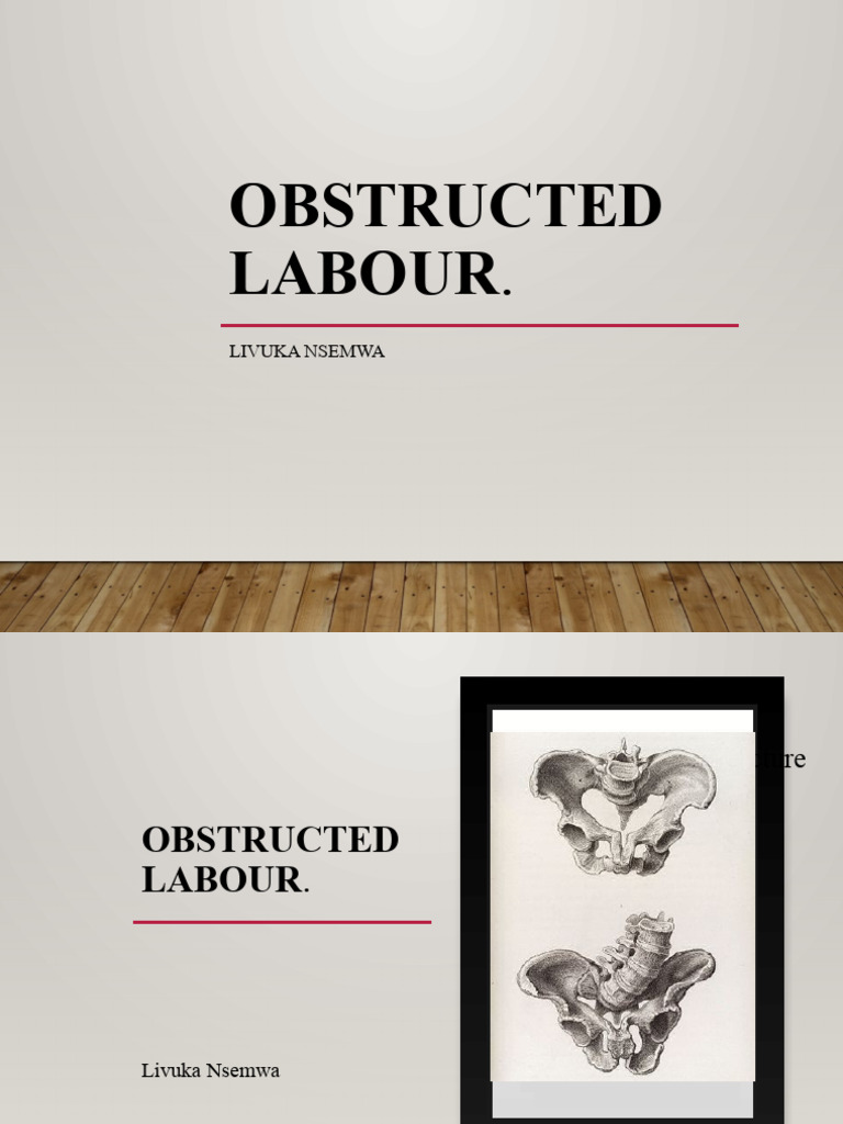 Obstructed Labour Pdf Childbirth Vagina