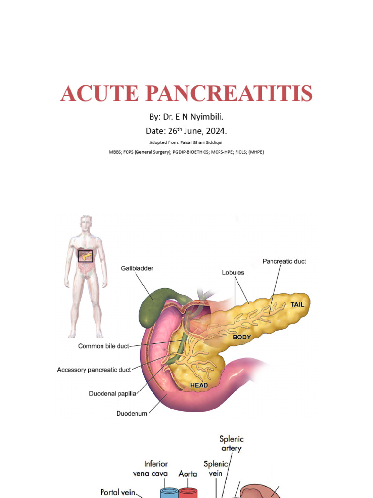 Acute Pancreatitis | PDF | Pancreas | Medical Specialties