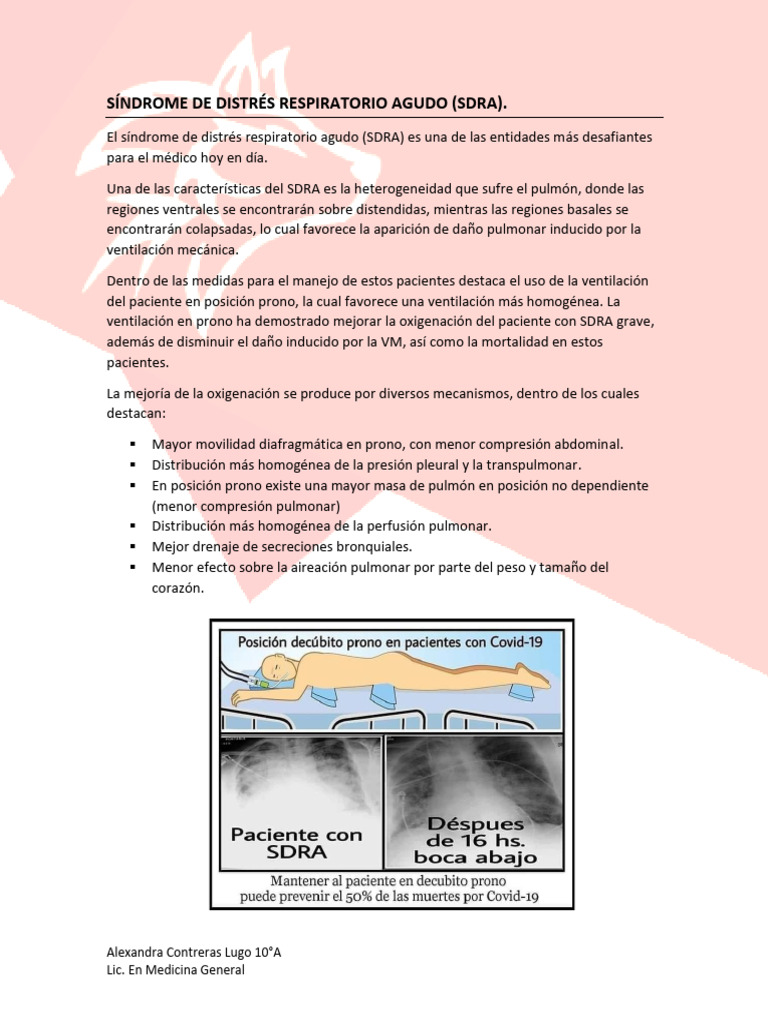 Síndrome de Distrés Respiratorio Agudo | PDF