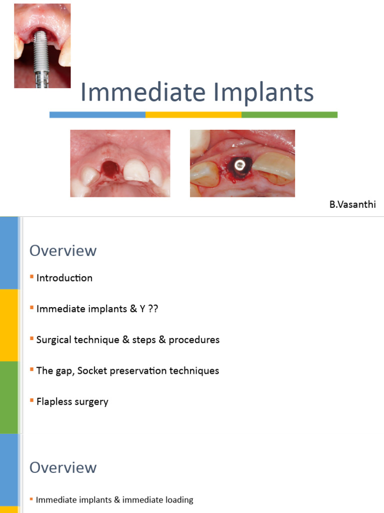 Immediate Implants: Techniques and Outcomes | PDF | Dental Implant ...