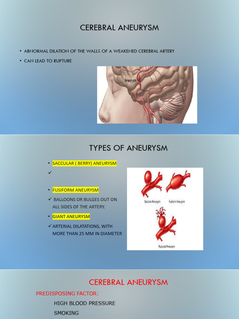Understanding Cerebral Aneurysms and Headaches | PDF | Headache | Migraine