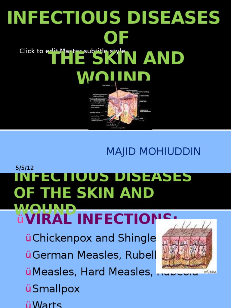 Infectious Diseases of the Skin and Wound Streptococcus Virus
