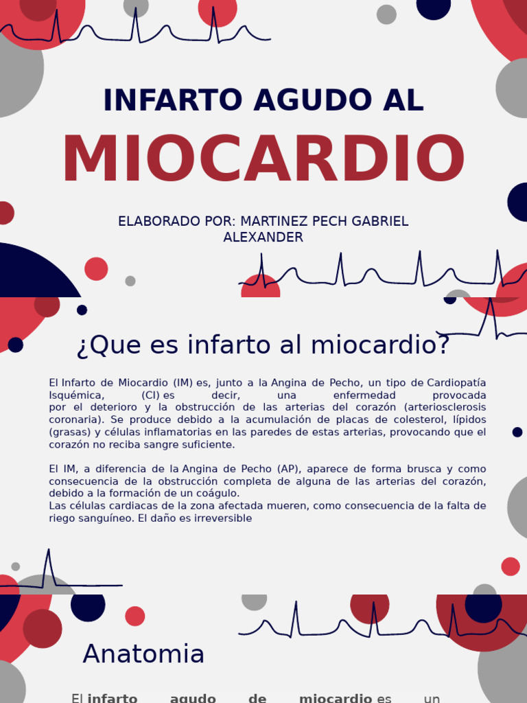 Complicaciones del Infarto Agudo al Miocardio | PDF | Infarto de ...