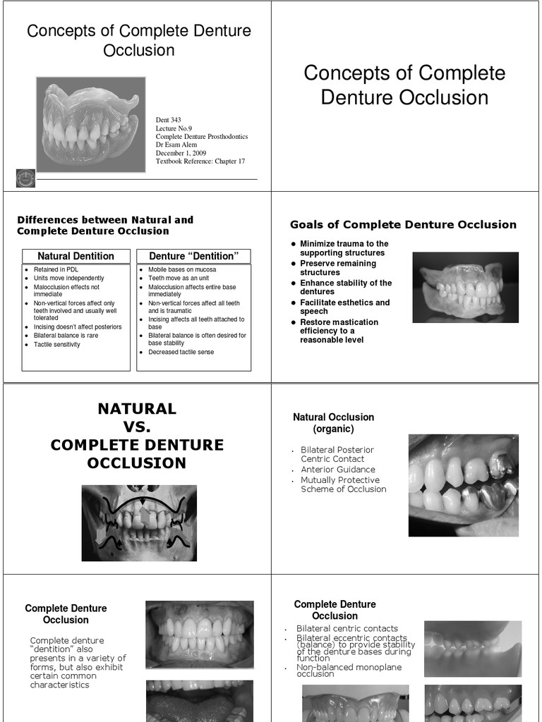 Dent 343 Lect 9 Handout PDF Dentures Human Tooth