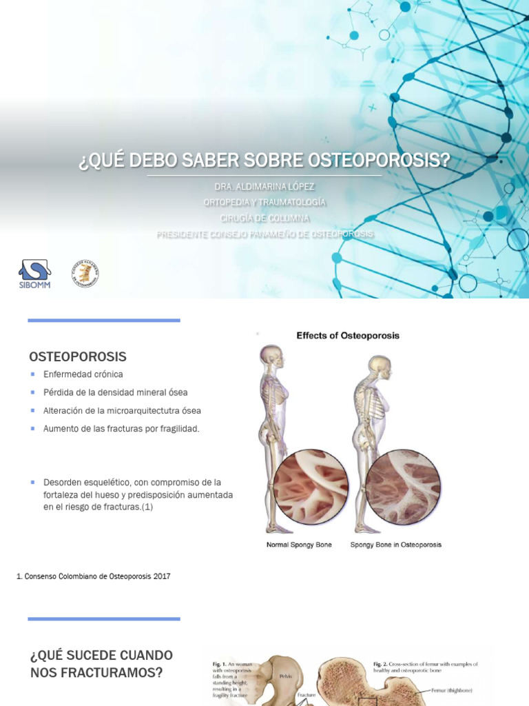 Ppt Que Debo Saber Sobre Osteoporosis - Dra Aldimarina | PDF ...