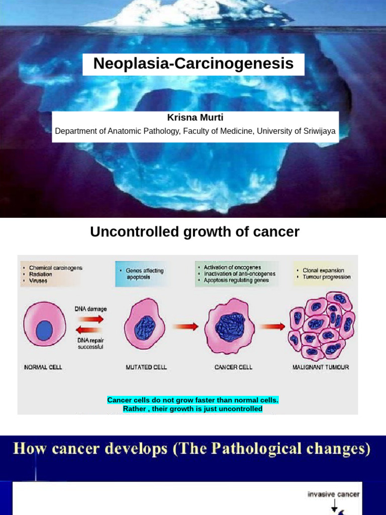 Neoplasia 2patobiology 1 | PDF | Oncogene | Carcinogenesis