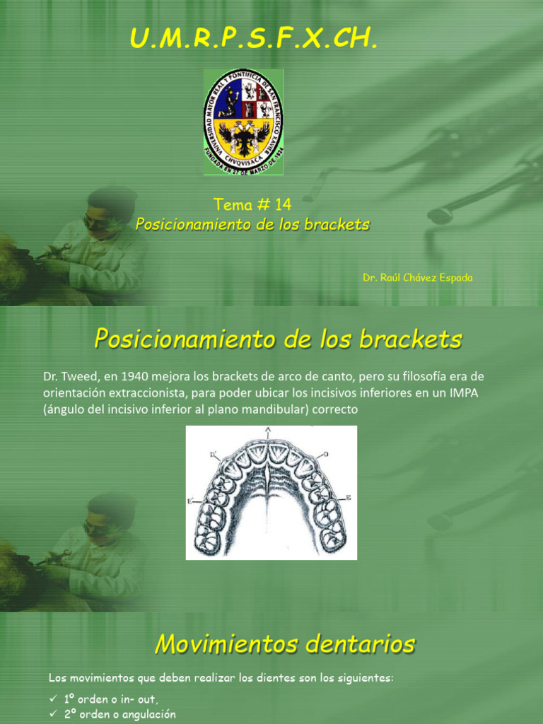 Tema # 14 Posicionamiento de Los Brackets | PDF | Anatomia dental | Boca