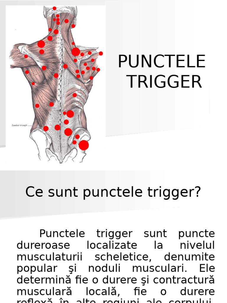 C7Masaj-Trigger Point 3 | PDF