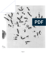 Fig.1 - 46,XY der(13_14)