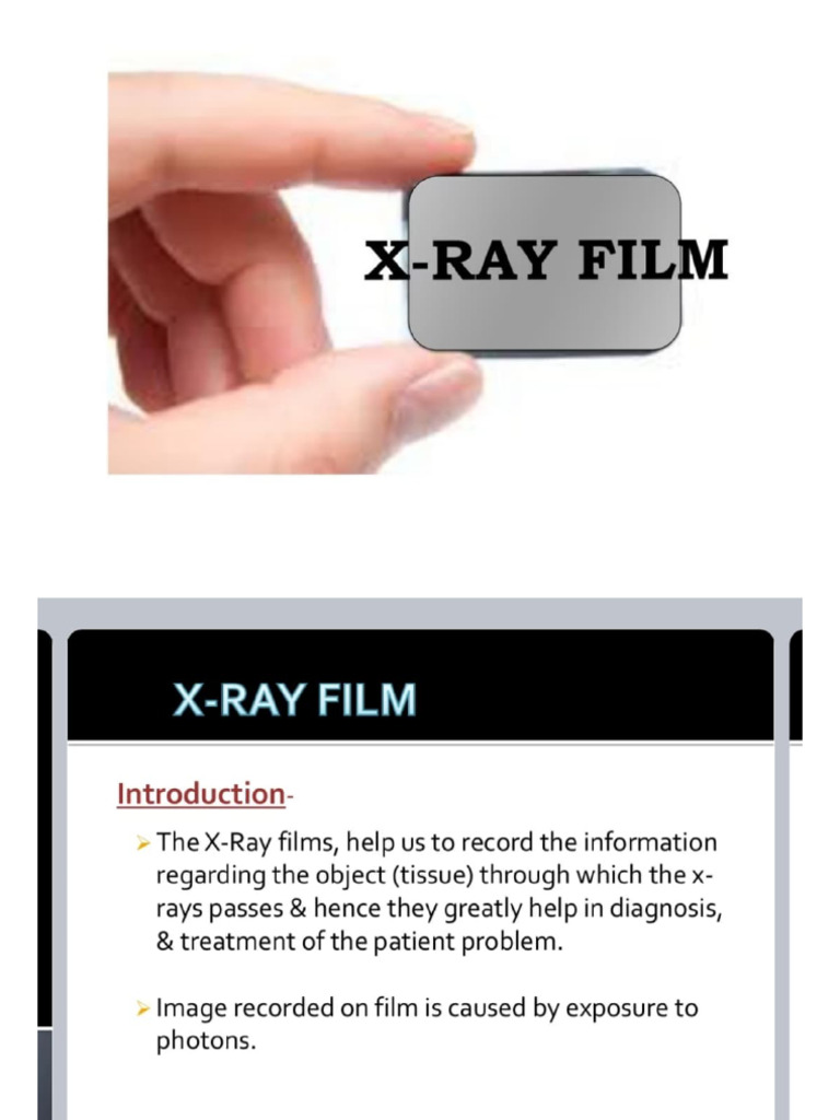 X Ray Film | PDF