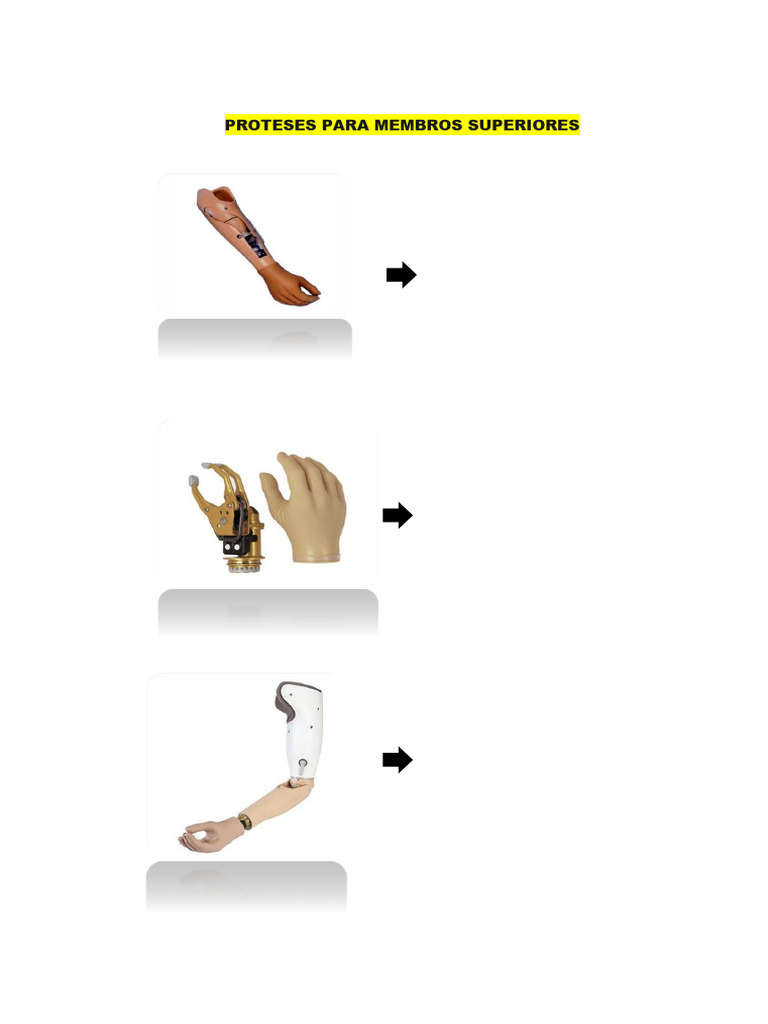 Proteses Mmss e Mmii | PDF