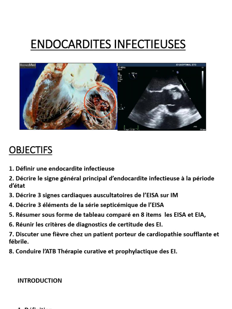 Endocardites Infectieuses | PDF