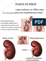 Trasplante Renal