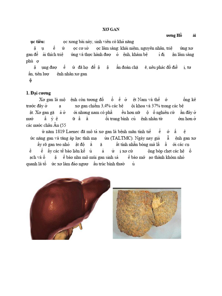 TÃ I Liá U Há C Táº P XÆ¡ Gan | PDF
