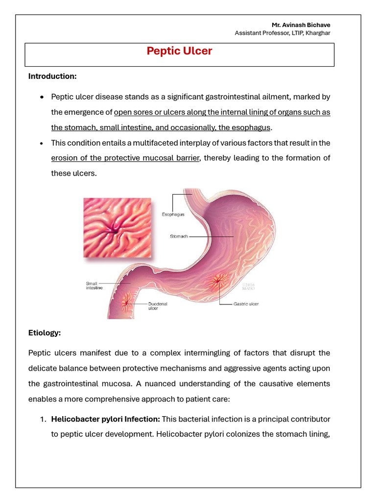 Peptic Ulcer Pdf
