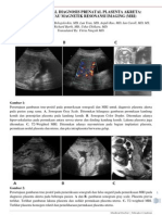 Lampiran Jurnal Diagnosis Prenatal Plasenta Akreta