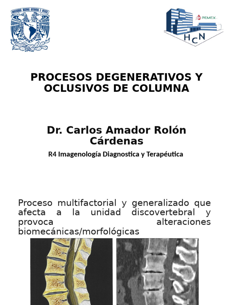 Procesos Degenerativos y Oclusivos de Columna | PDF