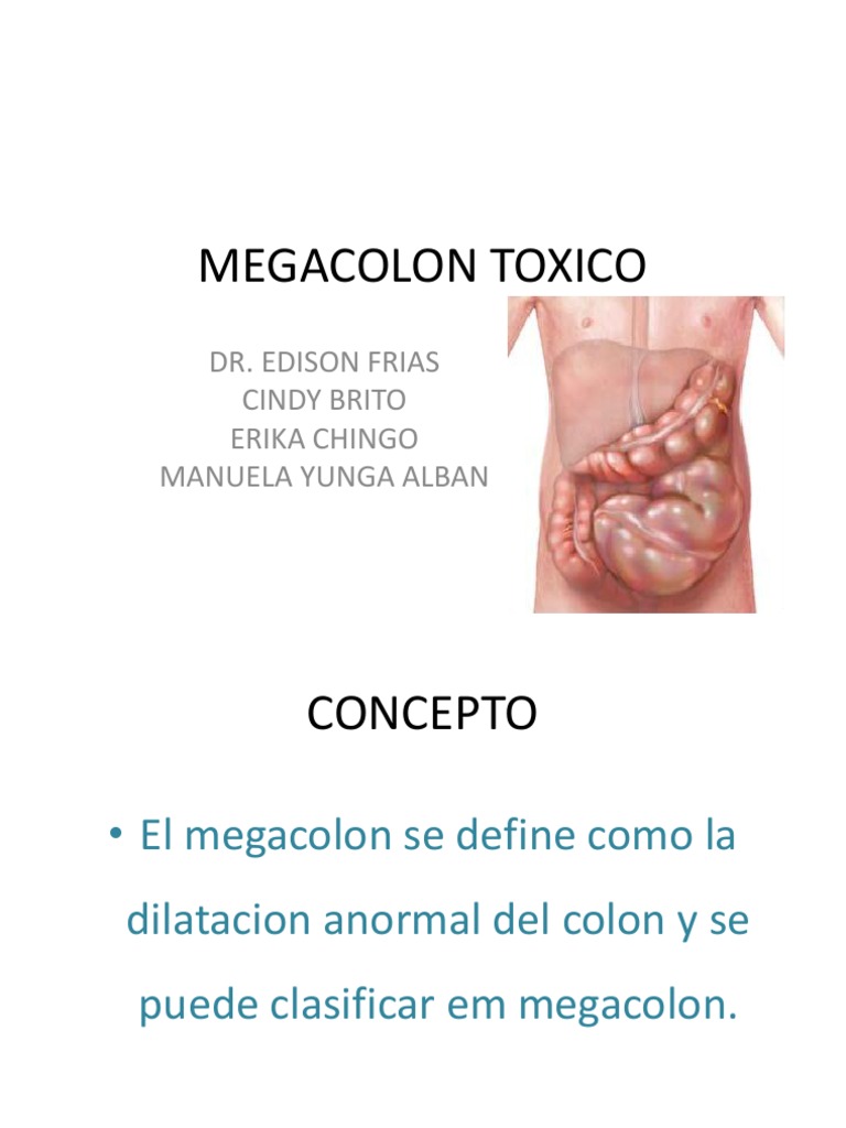 MEGACOLON TOXICO Enfermedad de Crohn Gastroenterología Prueba