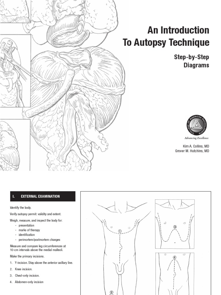 An Introduction To Autopsy Technique: Step-by-Step Diagrams | Download ...