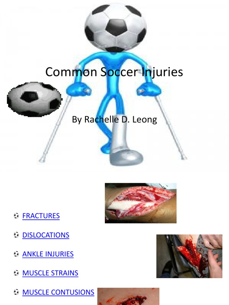 Common Soccer Injuries and First Aid | PDF | Home & Garden