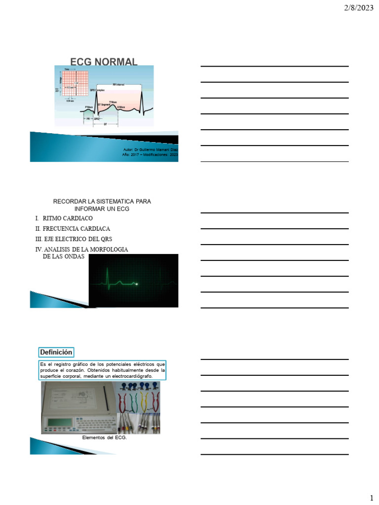 Clase I) Ecg Normal | PDF